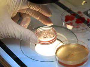 哪些遗传性疾病能通过第三代试管婴儿进行筛选？