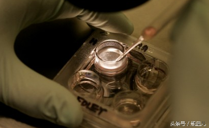 跟孕妈妈讲讲，试管婴儿那些事儿，防宝宝基因缺陷！