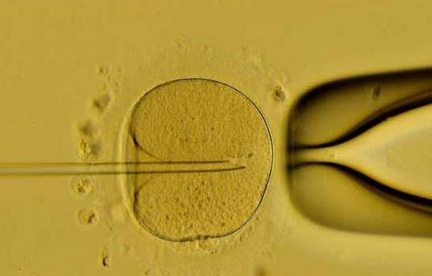 避免遗传性疾病传递给下一代，最好选择试管技术助孕！