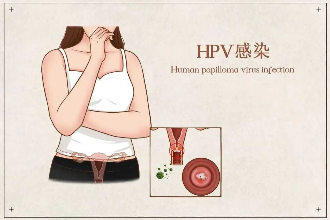 九价HPV疫苗“扩龄”至9~45岁，首针开打！它能预防5种癌症…