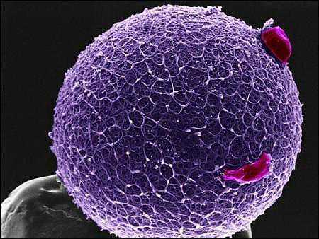 备孕｜监测卵泡可以走医保吗？